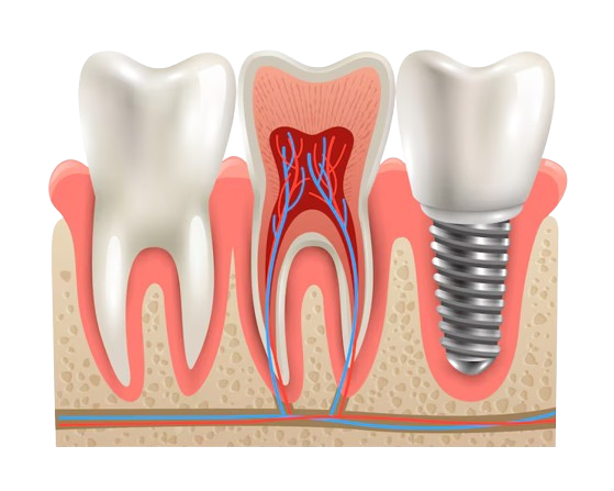 Periodontics care in pondicherry