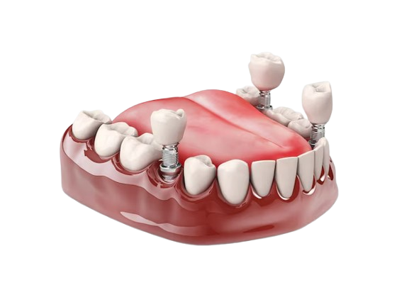 Cosmetic Dentistry